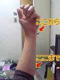 小指側のスジ