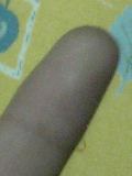 正常